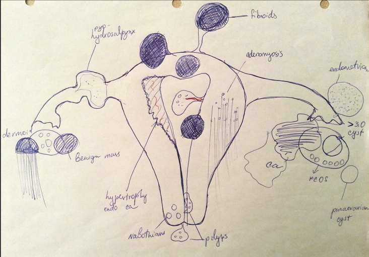 Visual Guide to pelvic pathology